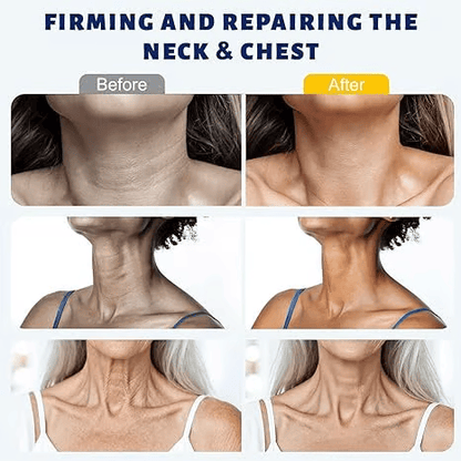 ✨ Tiworld™ Instant Neck Lift Cream  — 🧴 Infused with Retinol & Hyaluronic Acid | Firms the Neck, Reduces Wrinkles & Double Chin